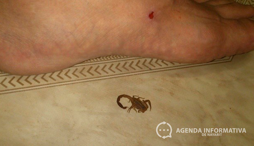 Registran más de 4 mil picaduras de alacrán en Nayarit en lo que va de 2025