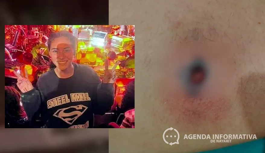 Joven de 15 años lucha por su vida tras picadura de araña violinista en Tepic