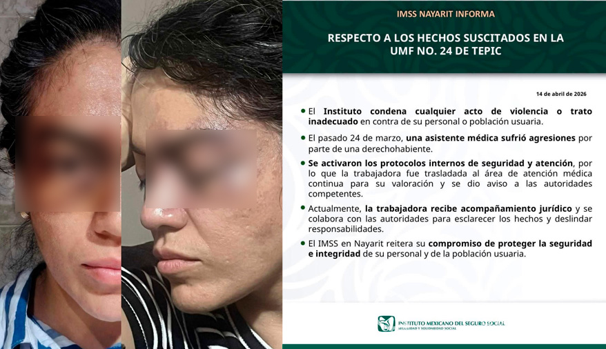 Asistente médica del IMSS agredida en UMF 24 de Tepic presenta lesiones en el rostro